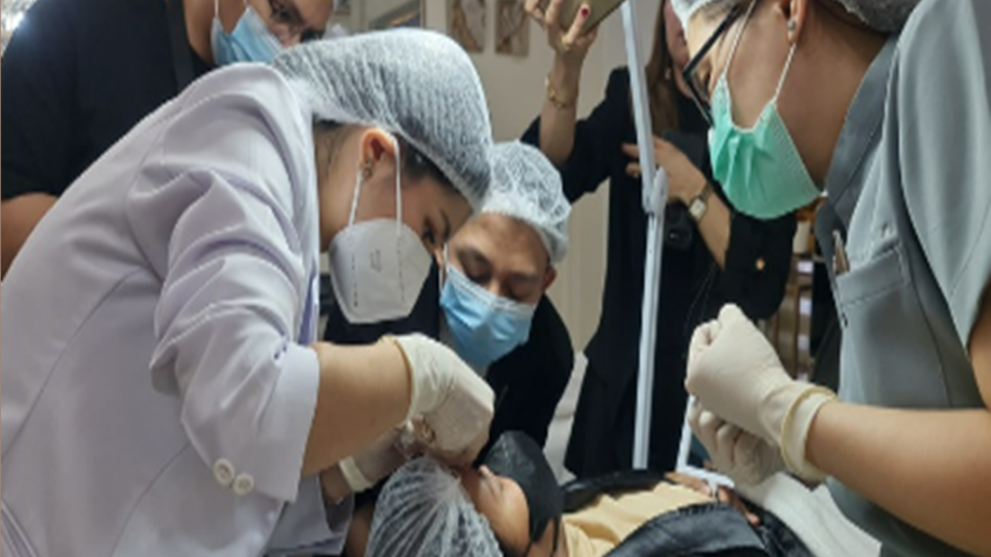 Double Stitch Instant Eyelid and Dimple Creation - Registration Only